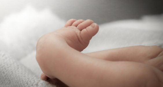 Golfová noha - dôvod pre potrat? Nie, ale s liečbou je potrebné začať včas