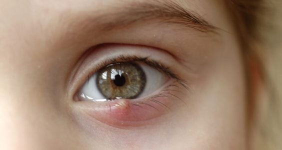 Vlčie zrno alebo jačmeň?
