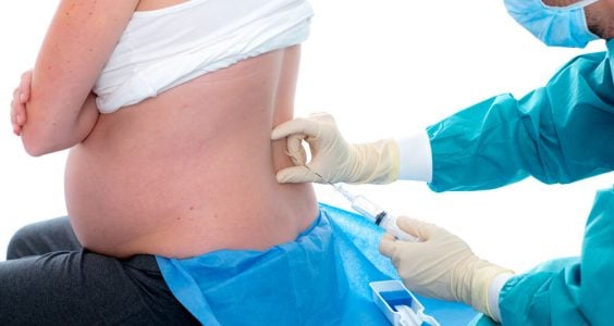 Epidurálna analgézia