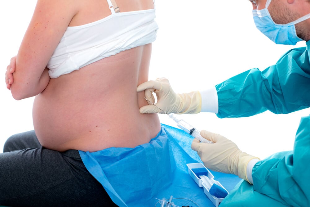 Epidurálna analgézia