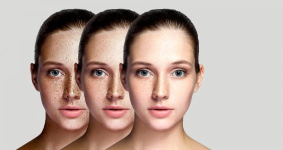 Eucerin Anti-pigment – výsledky testovania