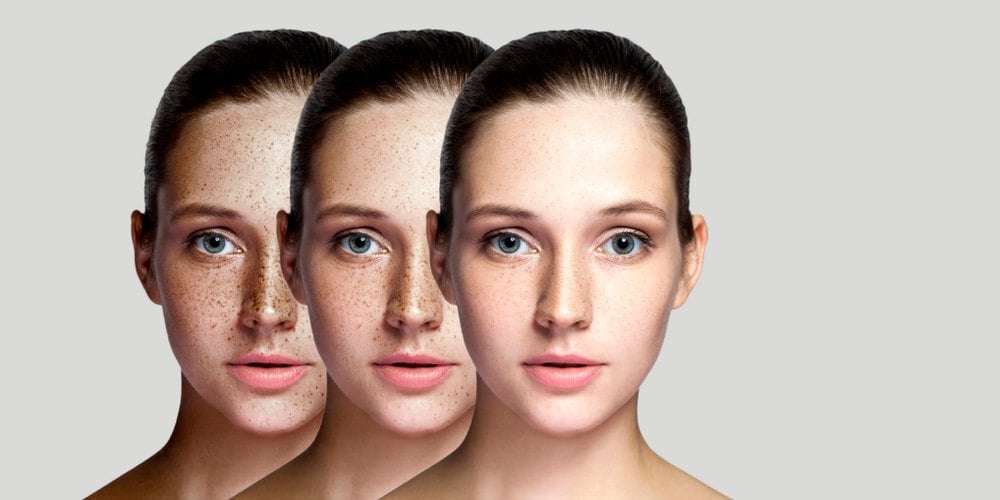 Eucerin Anti-pigment – výsledky testovania