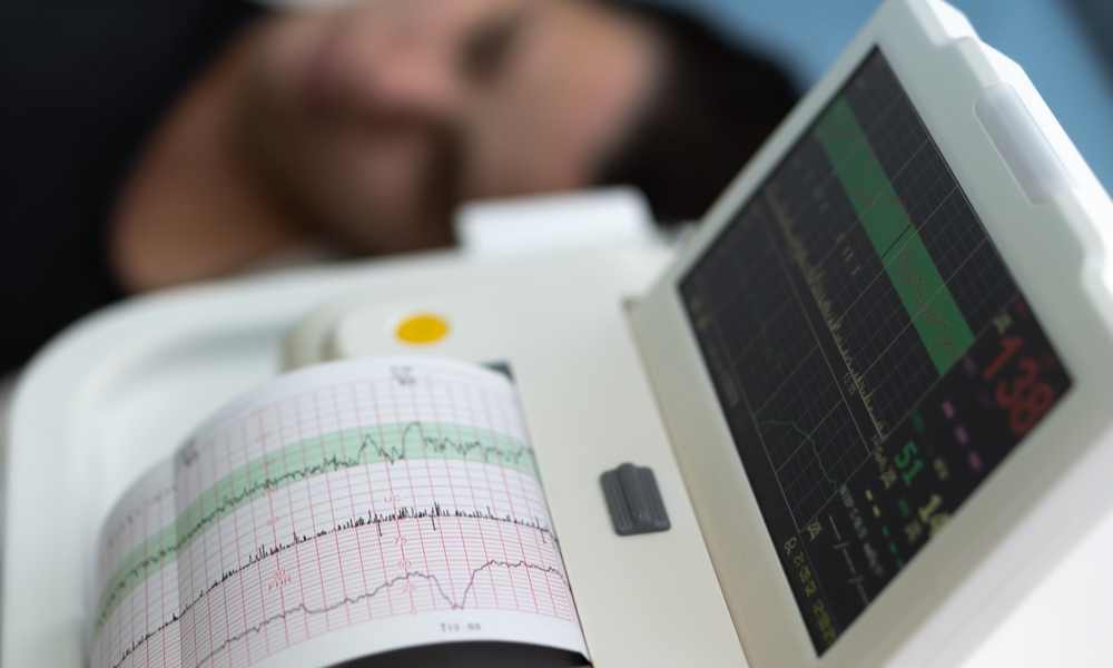Posledné vyšetrenia pred pôrodom – kardiotokografia
